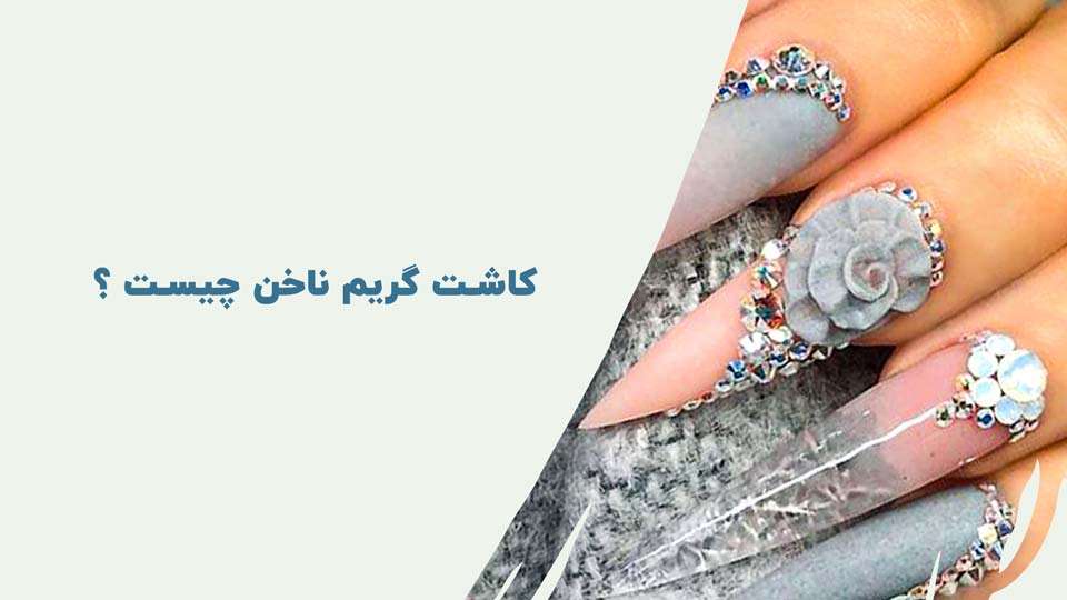 کاشت گریم ناخن چیست؟
